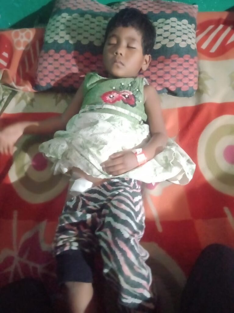 Child with PDA(hole in the heart) after surgery