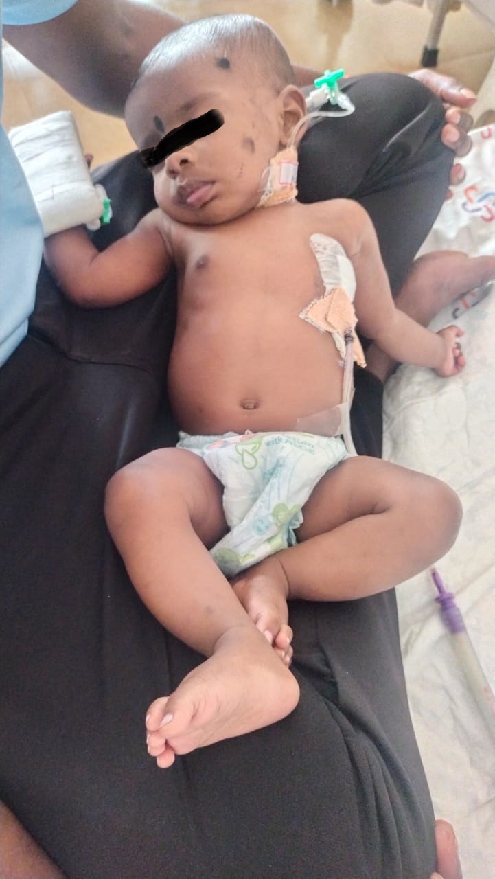 Heart Surgery for a baby