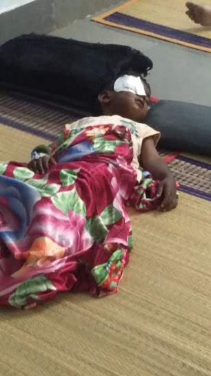 Eye Surgery for a child